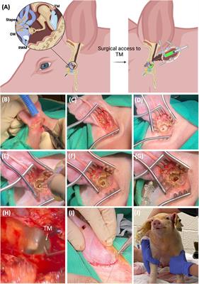 Surgical procedure of intratympanic injection and inner ear pharmacokinetics simulation in domestic pigs